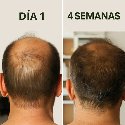 ACEITE DE BATANA™ ⭐⭐⭐⭐⭐Con Romero y Argán.