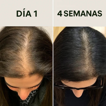ACEITE DE BATANA™ ⭐⭐⭐⭐⭐Con Romero y Argán.